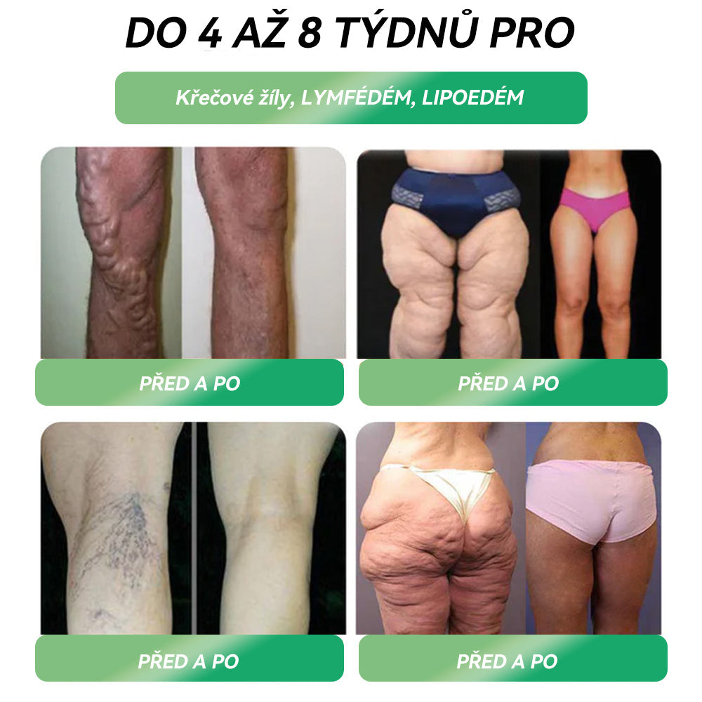 ✅ Doporučilo přes 100 000 lidí |Oficiální obchod | 𝑆𝑇𝐷𝐸𝐼® 👨👧👧👨👧👧 𝐺𝐿𝑃-1 𝐻𝑢𝑏𝑛𝑢𝑡í Ú𝑠𝑡𝑛í ř𝑒š𝑒𝑛í - Obezita, kardiovaskulární onemocnění, cukrovka, spánková apnoe, problémy s klouby a další