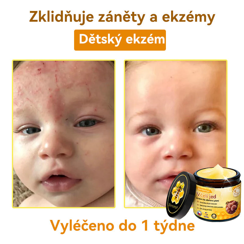 [💯Bez bolesti-bez vedlejších účinků] 𝐃𝐨𝐫𝐦𝐨𝐫𝐧𝐚®💥💥𝐕č𝐞𝐥í 𝐣𝐞𝐝 𝐊𝐫é𝐦 𝐧𝐚 𝐨𝐛𝐧𝐨𝐯𝐮 𝐩𝐥𝐞𝐭𝐢- POSLEDNÍ DEN SLEVA 70%