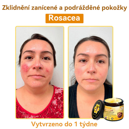 [💯Bez bolesti-bez vedlejších účinků] 𝐃𝐨𝐫𝐦𝐨𝐫𝐧𝐚®💥💥𝐕č𝐞𝐥í 𝐣𝐞𝐝 𝐊𝐫é𝐦 𝐧𝐚 𝐨𝐛𝐧𝐨𝐯𝐮 𝐩𝐥𝐞𝐭𝐢- POSLEDNÍ DEN SLEVA 70%