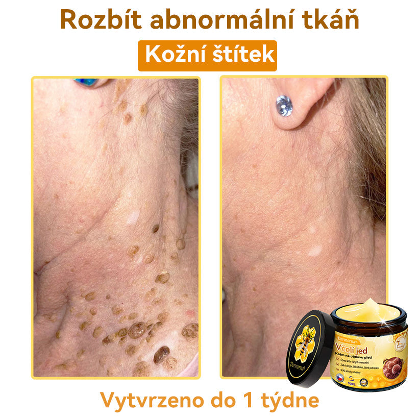 [💯Bez bolesti-bez vedlejších účinků] 𝐃𝐨𝐫𝐦𝐨𝐫𝐧𝐚®💥💥𝐕č𝐞𝐥í 𝐣𝐞𝐝 𝐊𝐫é𝐦 𝐧𝐚 𝐨𝐛𝐧𝐨𝐯𝐮 𝐩𝐥𝐞𝐭𝐢- POSLEDNÍ DEN SLEVA 70%