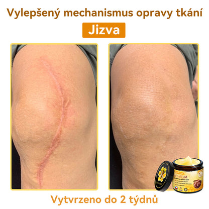 [💯Bez bolesti-bez vedlejších účinků] 𝐃𝐨𝐫𝐦𝐨𝐫𝐧𝐚®💥💥𝐕č𝐞𝐥í 𝐣𝐞𝐝 𝐊𝐫é𝐦 𝐧𝐚 𝐨𝐛𝐧𝐨𝐯𝐮 𝐩𝐥𝐞𝐭𝐢- POSLEDNÍ DEN SLEVA 70%
