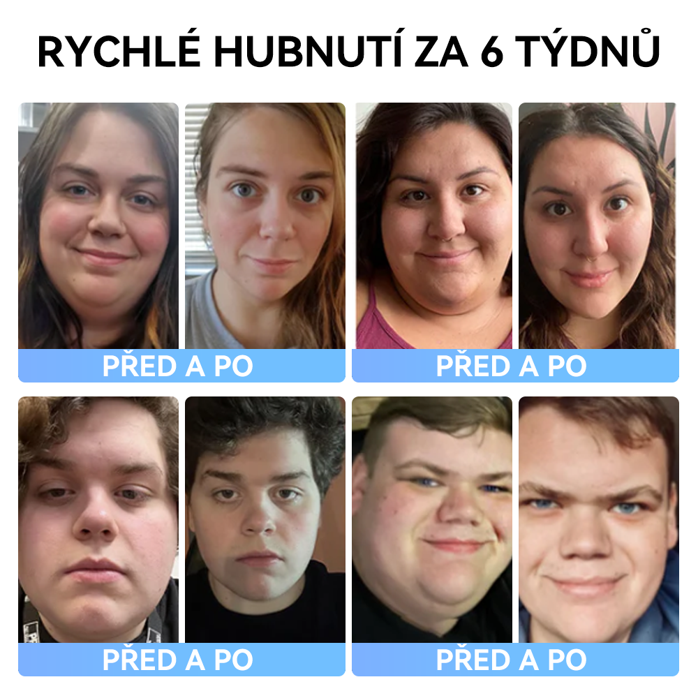 (✅Oficiální obchod) 𝑺𝐩𝐳𝐯® 𝐌𝐞𝐠𝐥𝐮𝐭𝐢𝐝 tekutina k perorálnímu podání💧 (Potravinářský produkt na spalování tuků vyvinutý Lékařskou fakultou Univerzity Karlovy v ČR)