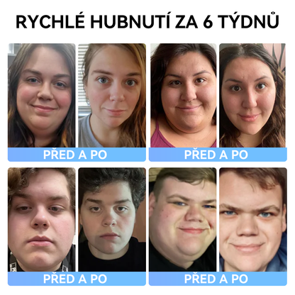 (✅Oficiální obchod) 𝑺𝐩𝐳𝐯® 𝐌𝐞𝐠𝐥𝐮𝐭𝐢𝐝 tekutina k perorálnímu podání💧 (Potravinářský produkt na spalování tuků vyvinutý Lékařskou fakultou Univerzity Karlovy v ČR)
