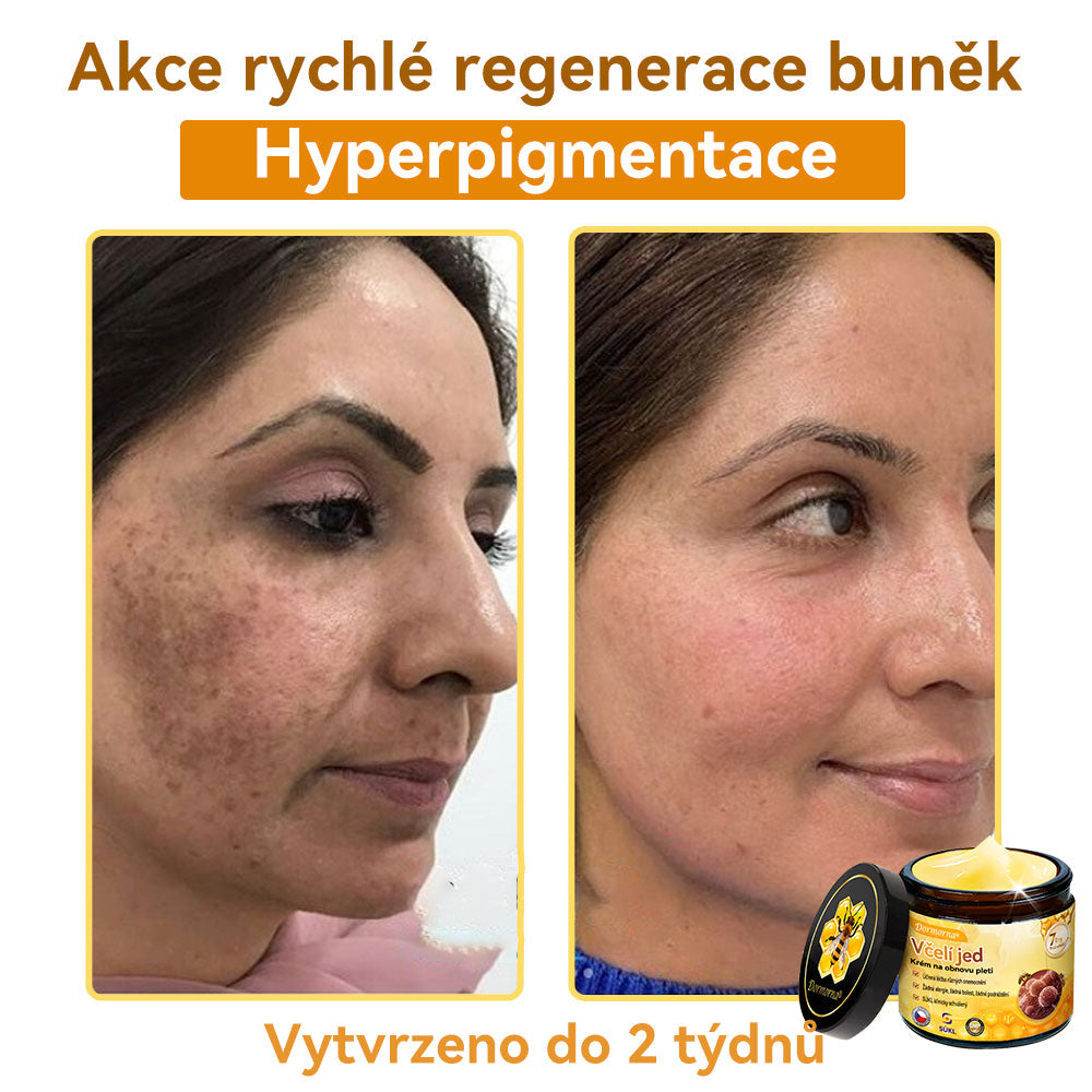 [💯Bez bolesti-bez vedlejších účinků] 𝐃𝐨𝐫𝐦𝐨𝐫𝐧𝐚®💥💥𝐕č𝐞𝐥í 𝐣𝐞𝐝 𝐊𝐫é𝐦 𝐧𝐚 𝐨𝐛𝐧𝐨𝐯𝐮 𝐩𝐥𝐞𝐭𝐢- POSLEDNÍ DEN SLEVA 70%