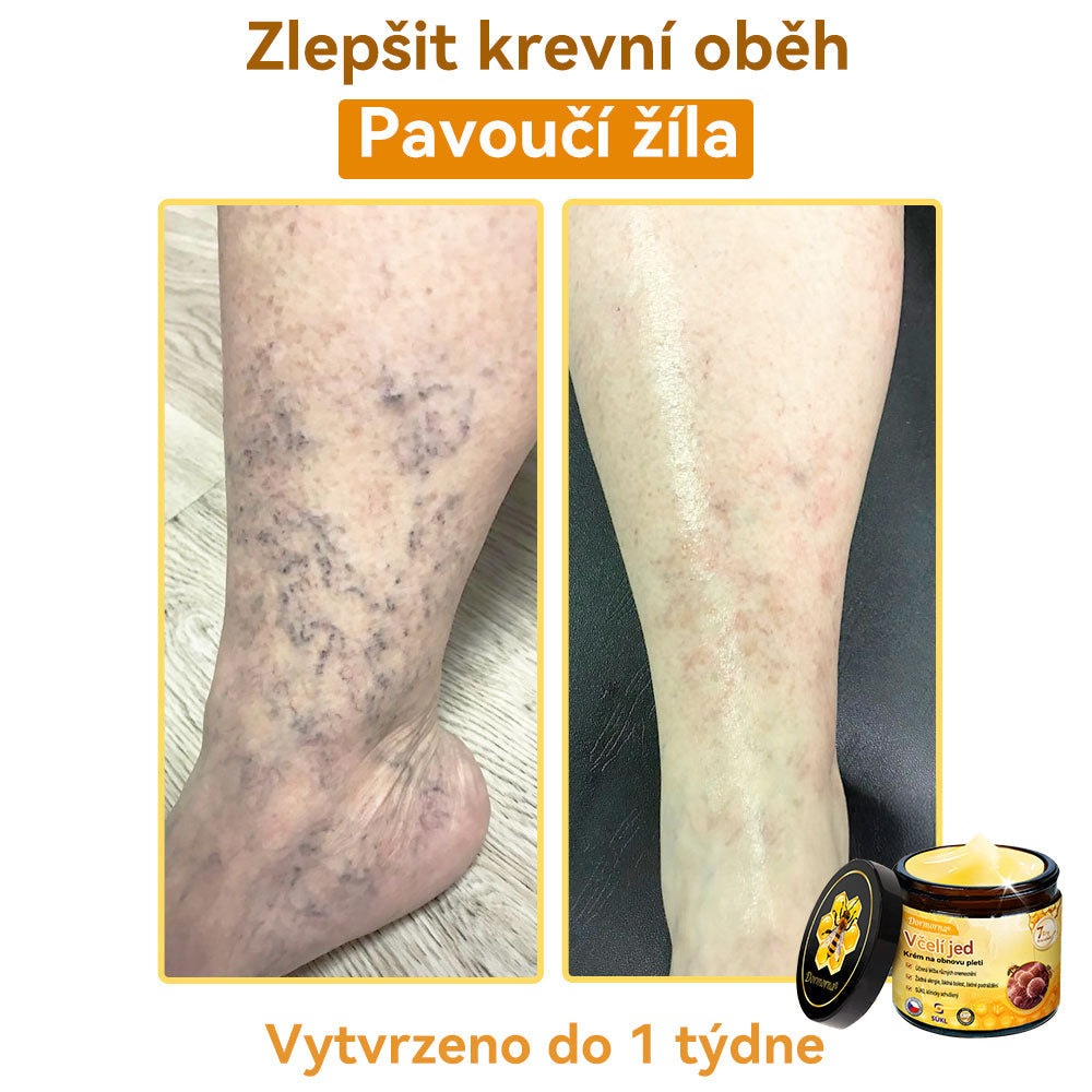 [💯Bez bolesti-bez vedlejších účinků] 𝐃𝐨𝐫𝐦𝐨𝐫𝐧𝐚®💥💥𝐕č𝐞𝐥í 𝐣𝐞𝐝 𝐊𝐫é𝐦 𝐧𝐚 𝐨𝐛𝐧𝐨𝐯𝐮 𝐩𝐥𝐞𝐭𝐢- POSLEDNÍ DEN SLEVA 70%