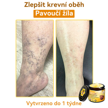 [💯Bez bolesti-bez vedlejších účinků] 𝐃𝐨𝐫𝐦𝐨𝐫𝐧𝐚®💥💥𝐕č𝐞𝐥í 𝐣𝐞𝐝 𝐊𝐫é𝐦 𝐧𝐚 𝐨𝐛𝐧𝐨𝐯𝐮 𝐩𝐥𝐞𝐭𝐢- POSLEDNÍ DEN SLEVA 70%