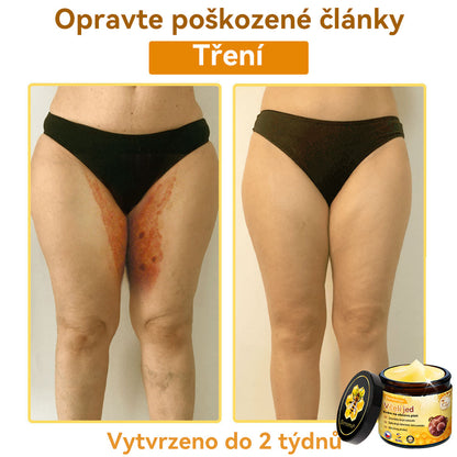 [💯Bez bolesti-bez vedlejších účinků] 𝐃𝐨𝐫𝐦𝐨𝐫𝐧𝐚®💥💥𝐕č𝐞𝐥í 𝐣𝐞𝐝 𝐊𝐫é𝐦 𝐧𝐚 𝐨𝐛𝐧𝐨𝐯𝐮 𝐩𝐥𝐞𝐭𝐢- POSLEDNÍ DEN SLEVA 70%