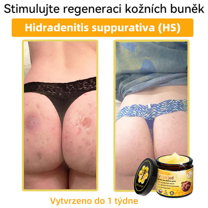 [💯Bez bolesti-bez vedlejších účinků] 𝐃𝐨𝐫𝐦𝐨𝐫𝐧𝐚®💥💥𝐕č𝐞𝐥í 𝐣𝐞𝐝 𝐊𝐫é𝐦 𝐧𝐚 𝐨𝐛𝐧𝐨𝐯𝐮 𝐩𝐥𝐞𝐭𝐢- POSLEDNÍ DEN SLEVA 70%