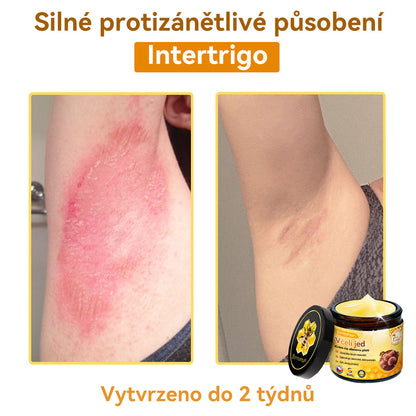 [💯Bez bolesti-bez vedlejších účinků] 𝐃𝐨𝐫𝐦𝐨𝐫𝐧𝐚®💥💥𝐕č𝐞𝐥í 𝐣𝐞𝐝 𝐊𝐫é𝐦 𝐧𝐚 𝐨𝐛𝐧𝐨𝐯𝐮 𝐩𝐥𝐞𝐭𝐢- POSLEDNÍ DEN SLEVA 70%