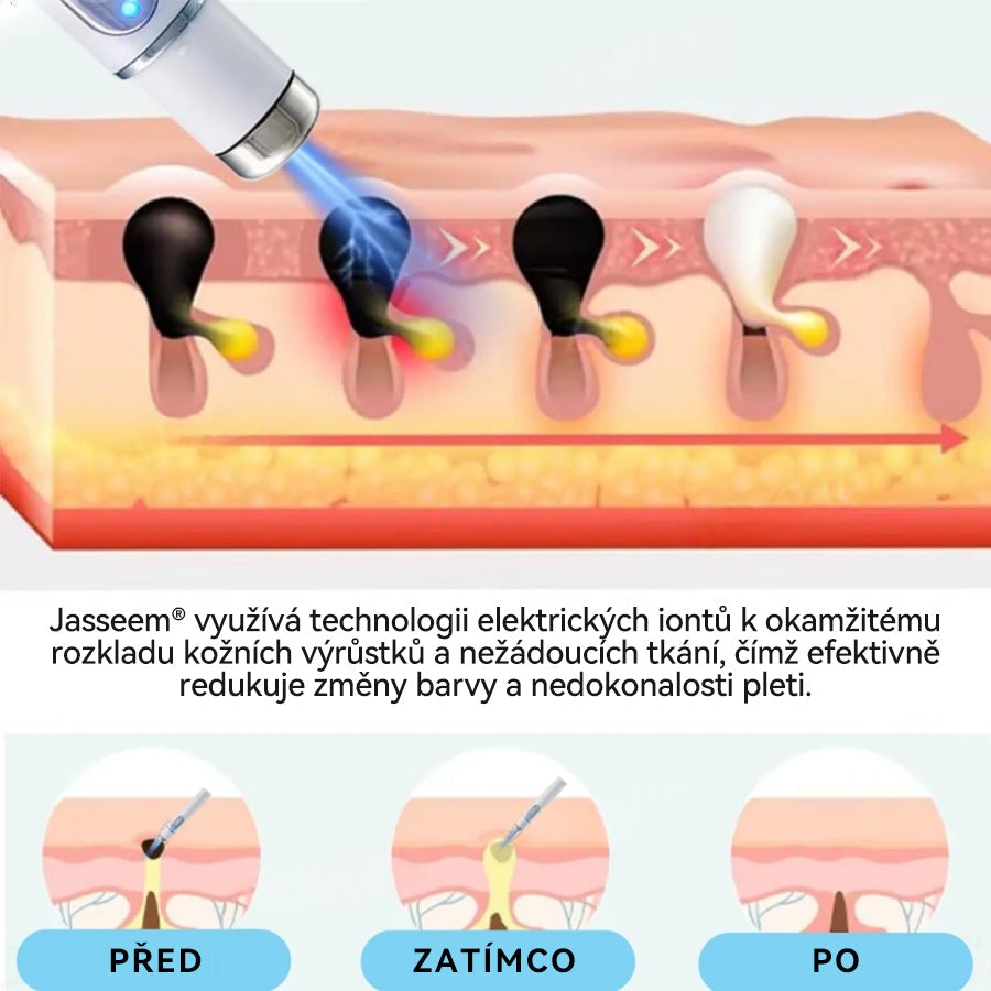 [✅Viditelné výsledky již za 7 dní] 𝐉𝐚𝐬𝐬𝐞𝐞𝐦® 🔥🔥 𝐍𝐞𝐢𝐧𝐯𝐚𝐳𝐢𝐯𝐧í 𝐦𝐚𝐭𝐞ř𝐬𝐤á 𝐳𝐧𝐚𝐦é𝐧𝐤𝐚 𝐚 𝐛𝐫𝐚𝐝𝐚𝐯𝐢𝐜𝐞 𝐎𝐝𝐬𝐭𝐫𝐚ň𝐨𝐯𝐚𝐜í 𝐥𝐚𝐬𝐞𝐫𝐨𝐯é 𝐩𝐞𝐫𝐨 🎉Doporučení dermatologové v České republice