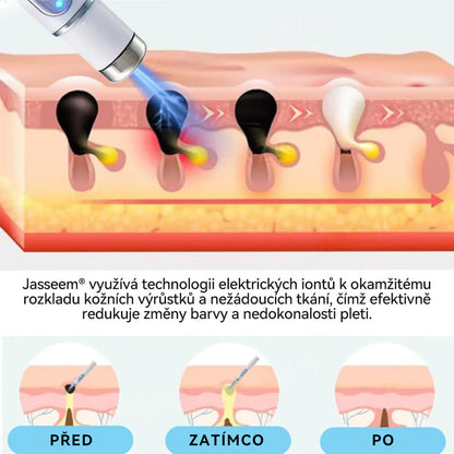 [✅Viditelné výsledky již za 7 dní] 𝐉𝐚𝐬𝐬𝐞𝐞𝐦® 🔥🔥 𝐍𝐞𝐢𝐧𝐯𝐚𝐳𝐢𝐯𝐧í 𝐦𝐚𝐭𝐞ř𝐬𝐤á 𝐳𝐧𝐚𝐦é𝐧𝐤𝐚 𝐚 𝐛𝐫𝐚𝐝𝐚𝐯𝐢𝐜𝐞 𝐎𝐝𝐬𝐭𝐫𝐚ň𝐨𝐯𝐚𝐜í 𝐥𝐚𝐬𝐞𝐫𝐨𝐯é 𝐩𝐞𝐫𝐨 🎉Doporučení dermatologové v České republice