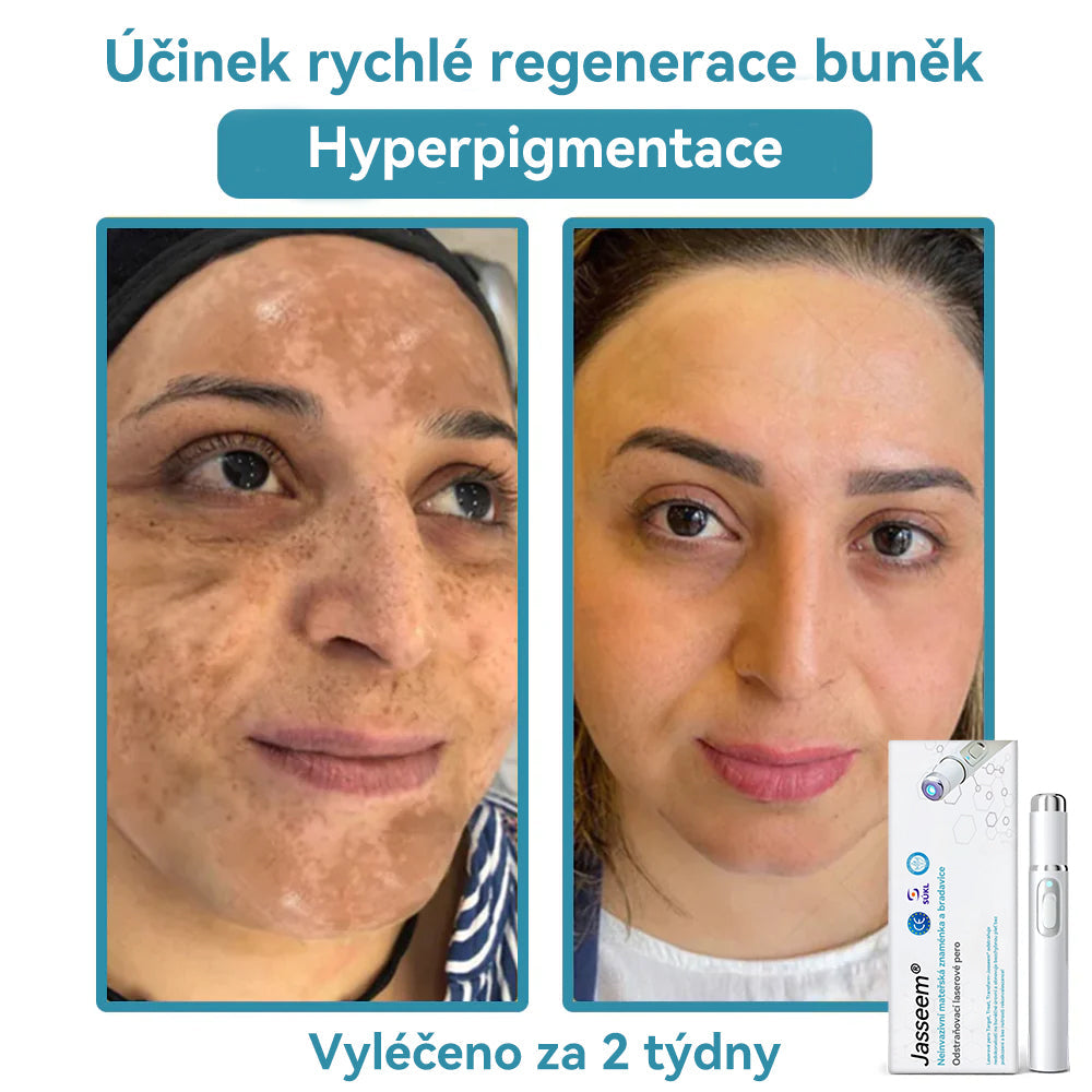 [✅Viditelné výsledky již za 7 dní] 𝐉𝐚𝐬𝐬𝐞𝐞𝐦® 🔥🔥 𝐍𝐞𝐢𝐧𝐯𝐚𝐳𝐢𝐯𝐧í 𝐦𝐚𝐭𝐞ř𝐬𝐤á 𝐳𝐧𝐚𝐦é𝐧𝐤𝐚 𝐚 𝐛𝐫𝐚𝐝𝐚𝐯𝐢𝐜𝐞 𝐎𝐝𝐬𝐭𝐫𝐚ň𝐨𝐯𝐚𝐜í 𝐥𝐚𝐬𝐞𝐫𝐨𝐯é 𝐩𝐞𝐫𝐨 🎉Doporučení dermatologové v České republice