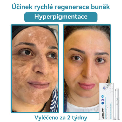 [✅Viditelné výsledky již za 7 dní] 𝐉𝐚𝐬𝐬𝐞𝐞𝐦® 🔥🔥 𝐍𝐞𝐢𝐧𝐯𝐚𝐳𝐢𝐯𝐧í 𝐦𝐚𝐭𝐞ř𝐬𝐤á 𝐳𝐧𝐚𝐦é𝐧𝐤𝐚 𝐚 𝐛𝐫𝐚𝐝𝐚𝐯𝐢𝐜𝐞 𝐎𝐝𝐬𝐭𝐫𝐚ň𝐨𝐯𝐚𝐜í 𝐥𝐚𝐬𝐞𝐫𝐨𝐯é 𝐩𝐞𝐫𝐨 🎉Doporučení dermatologové v České republice