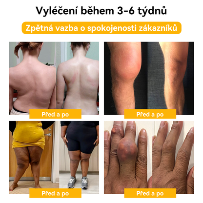 [✅ Oficiální obchod]: 𝐒𝐩𝐳𝐯™ 🌏🌏 Krém na léčbu kloubů a kostí s včelím jedem 🐝 (Novozélandský včelí extrakt, specializovaný na ortopedická onemocnění a bolesti při artritidě)