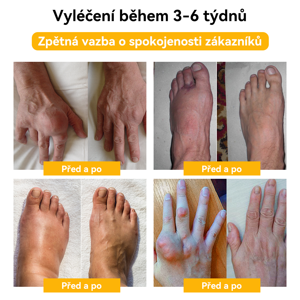 [✅ Oficiální obchod]: 𝐒𝐩𝐳𝐯™ 🌏🌏 Krém na léčbu kloubů a kostí s včelím jedem 🐝 (Novozélandský včelí extrakt, specializovaný na ortopedická onemocnění a bolesti při artritidě)