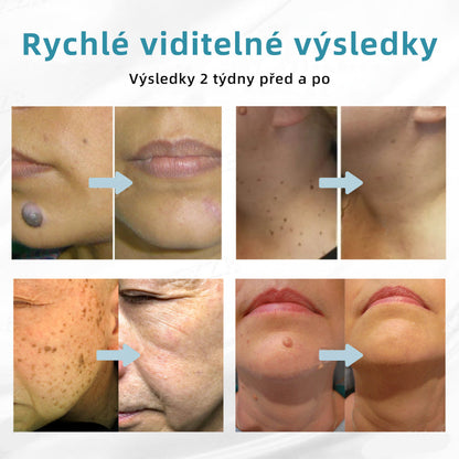 [✅Viditelné výsledky již za 7 dní] 𝐉𝐚𝐬𝐬𝐞𝐞𝐦® 🔥🔥 𝐍𝐞𝐢𝐧𝐯𝐚𝐳𝐢𝐯𝐧í 𝐦𝐚𝐭𝐞ř𝐬𝐤á 𝐳𝐧𝐚𝐦é𝐧𝐤𝐚 𝐚 𝐛𝐫𝐚𝐝𝐚𝐯𝐢𝐜𝐞 𝐎𝐝𝐬𝐭𝐫𝐚ň𝐨𝐯𝐚𝐜í 𝐥𝐚𝐬𝐞𝐫𝐨𝐯é 𝐩𝐞𝐫𝐨 🎉Doporučení dermatologové v České republice
