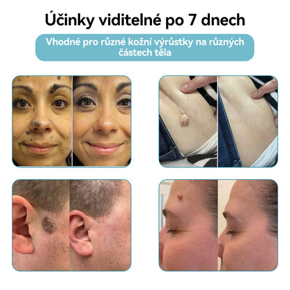 [✅Viditelné výsledky již za 7 dní] 𝐉𝐚𝐬𝐬𝐞𝐞𝐦® 🔥🔥 𝐍𝐞𝐢𝐧𝐯𝐚𝐳𝐢𝐯𝐧í 𝐦𝐚𝐭𝐞ř𝐬𝐤á 𝐳𝐧𝐚𝐦é𝐧𝐤𝐚 𝐚 𝐛𝐫𝐚𝐝𝐚𝐯𝐢𝐜𝐞 𝐎𝐝𝐬𝐭𝐫𝐚ň𝐨𝐯𝐚𝐜í 𝐥𝐚𝐬𝐞𝐫𝐨𝐯é 𝐩𝐞𝐫𝐨 🎉Doporučení dermatologové v České republice