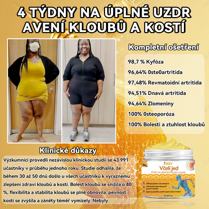 [✅ Oficiální obchod]: 𝐒𝐩𝐳𝐯™ 🌏🌏 Krém na léčbu kloubů a kostí s včelím jedem 🐝 (Novozélandský včelí extrakt, specializovaný na ortopedická onemocnění a bolesti při artritidě)