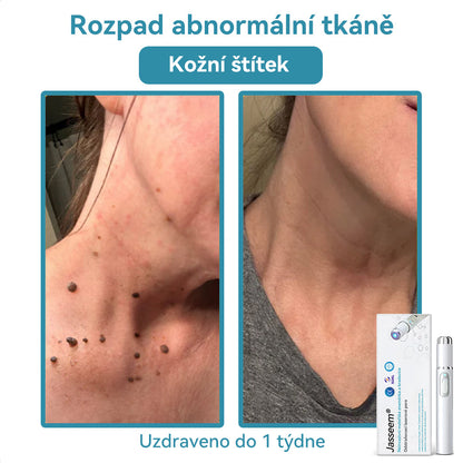 [✅Viditelné výsledky již za 7 dní] 𝐉𝐚𝐬𝐬𝐞𝐞𝐦® 🔥🔥 𝐍𝐞𝐢𝐧𝐯𝐚𝐳𝐢𝐯𝐧í 𝐦𝐚𝐭𝐞ř𝐬𝐤á 𝐳𝐧𝐚𝐦é𝐧𝐤𝐚 𝐚 𝐛𝐫𝐚𝐝𝐚𝐯𝐢𝐜𝐞 𝐎𝐝𝐬𝐭𝐫𝐚ň𝐨𝐯𝐚𝐜í 𝐥𝐚𝐬𝐞𝐫𝐨𝐯é 𝐩𝐞𝐫𝐨 🎉Doporučení dermatologové v České republice