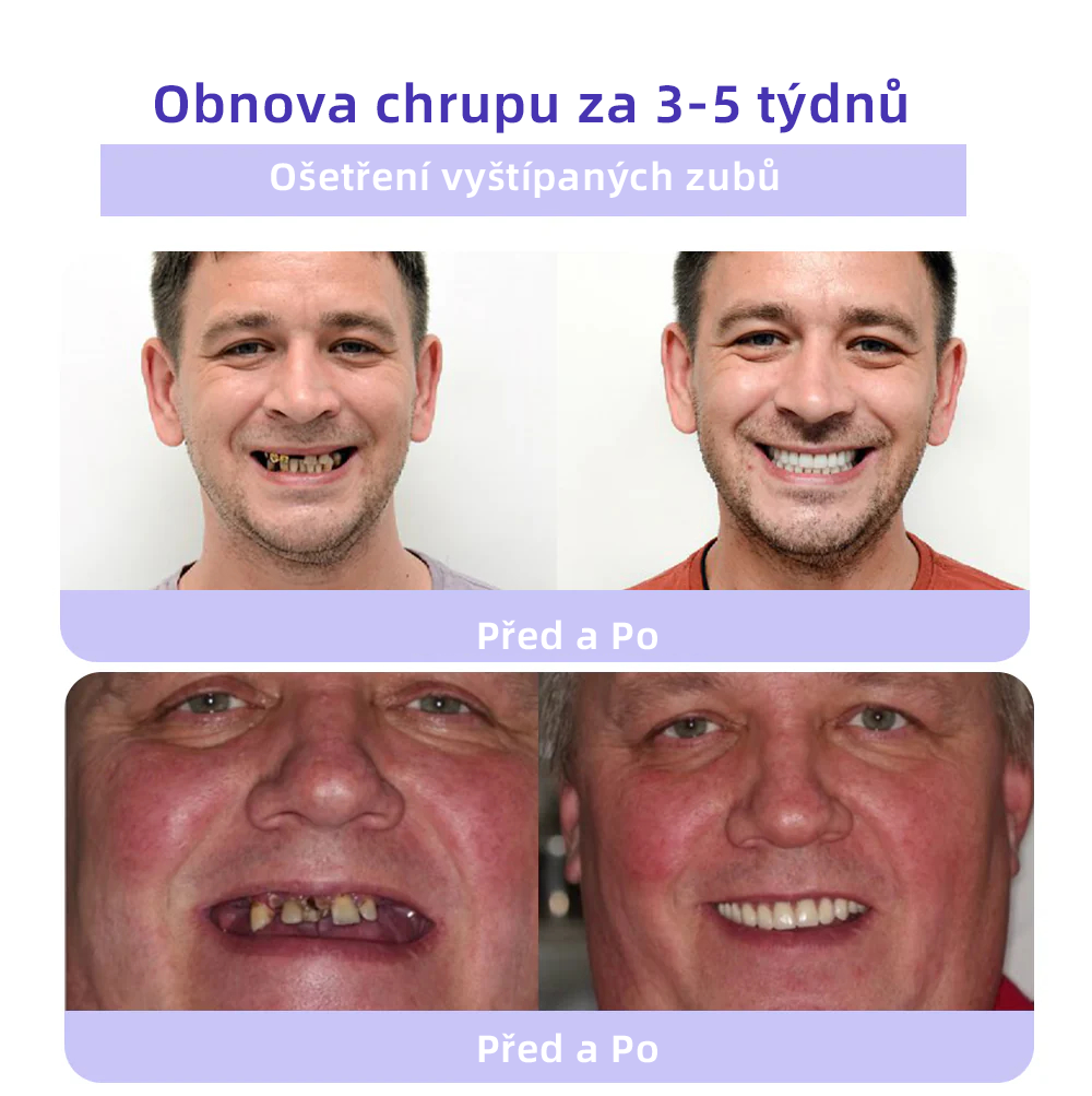 [✅Oficiální obchod.]𝐎𝐲𝐢𝐤𝐞𝐲™ Prášek na obnovu zubní minerálů 👩‍⚕️ – produkt pro péči o ústní dutinu (doporučeno odborníky České stomatologické komory, ČSK)