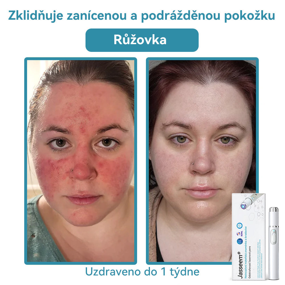 [✅Viditelné výsledky již za 7 dní] 𝐉𝐚𝐬𝐬𝐞𝐞𝐦® 🔥🔥 𝐍𝐞𝐢𝐧𝐯𝐚𝐳𝐢𝐯𝐧í 𝐦𝐚𝐭𝐞ř𝐬𝐤á 𝐳𝐧𝐚𝐦é𝐧𝐤𝐚 𝐚 𝐛𝐫𝐚𝐝𝐚𝐯𝐢𝐜𝐞 𝐎𝐝𝐬𝐭𝐫𝐚ň𝐨𝐯𝐚𝐜í 𝐥𝐚𝐬𝐞𝐫𝐨𝐯é 𝐩𝐞𝐫𝐨 🎉Doporučení dermatologové v České republice
