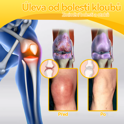 [✅ Oficiální obchod]: 𝐒𝐩𝐳𝐯™ 🌏🌏 Krém na léčbu kloubů a kostí s včelím jedem 🐝 (Novozélandský včelí extrakt, specializovaný na ortopedická onemocnění a bolesti při artritidě)