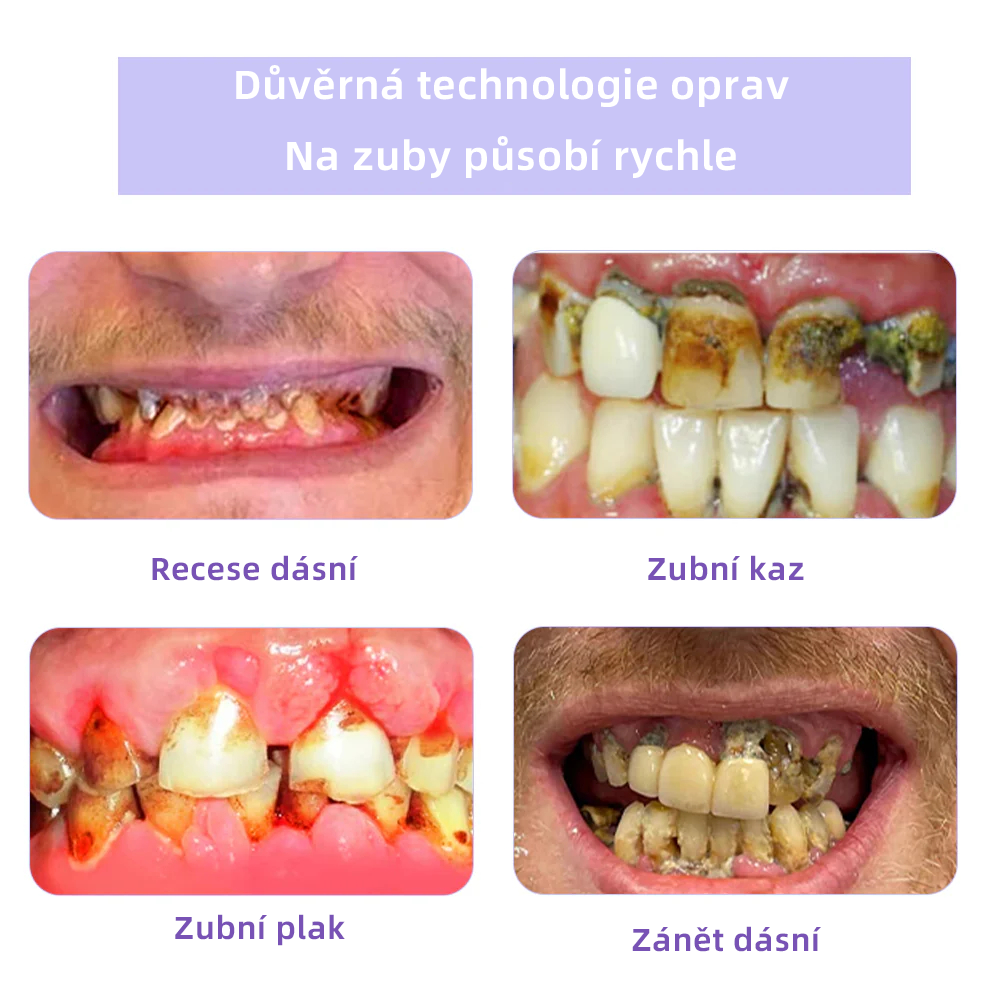 [✅Oficiální obchod.]𝐎𝐲𝐢𝐤𝐞𝐲™ Prášek na obnovu zubní minerálů 👩‍⚕️ – produkt pro péči o ústní dutinu (doporučeno odborníky České stomatologické komory, ČSK)
