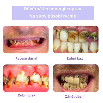 [✅Oficiální obchod.]𝐎𝐲𝐢𝐤𝐞𝐲™ Prášek na obnovu zubní minerálů 👩‍⚕️ – produkt pro péči o ústní dutinu (doporučeno odborníky České stomatologické komory, ČSK)