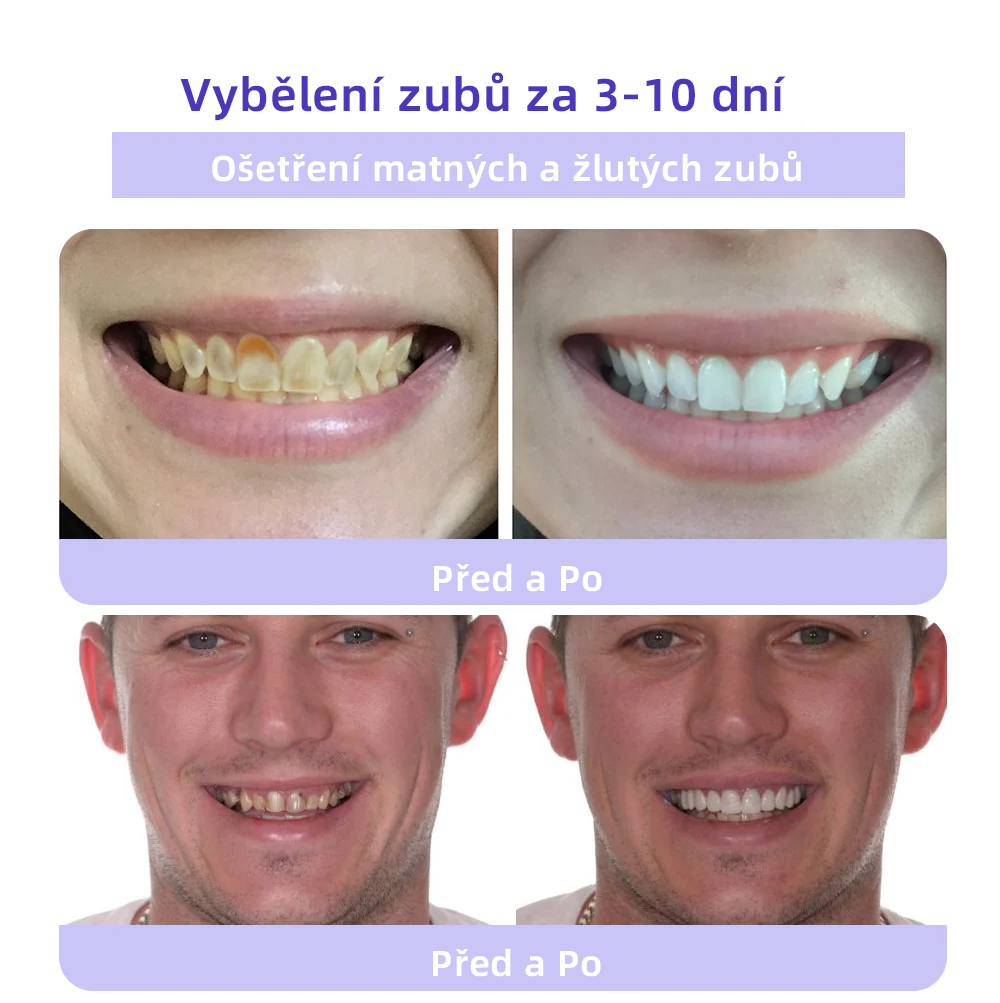[✅Oficiální obchod.]𝐎𝐲𝐢𝐤𝐞𝐲™ Prášek na obnovu zubní minerálů 👩‍⚕️ – produkt pro péči o ústní dutinu (doporučeno odborníky České stomatologické komory, ČSK)