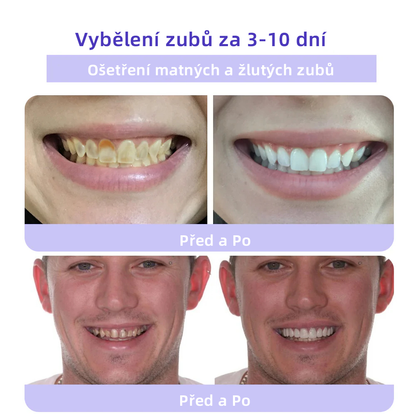 [✅Oficiální obchod.]𝐎𝐲𝐢𝐤𝐞𝐲™ Prášek na obnovu zubní minerálů 👩‍⚕️ – produkt pro péči o ústní dutinu (doporučeno odborníky České stomatologické komory, ČSK)